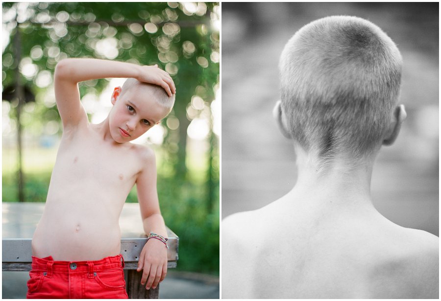 Boy with shaved head.